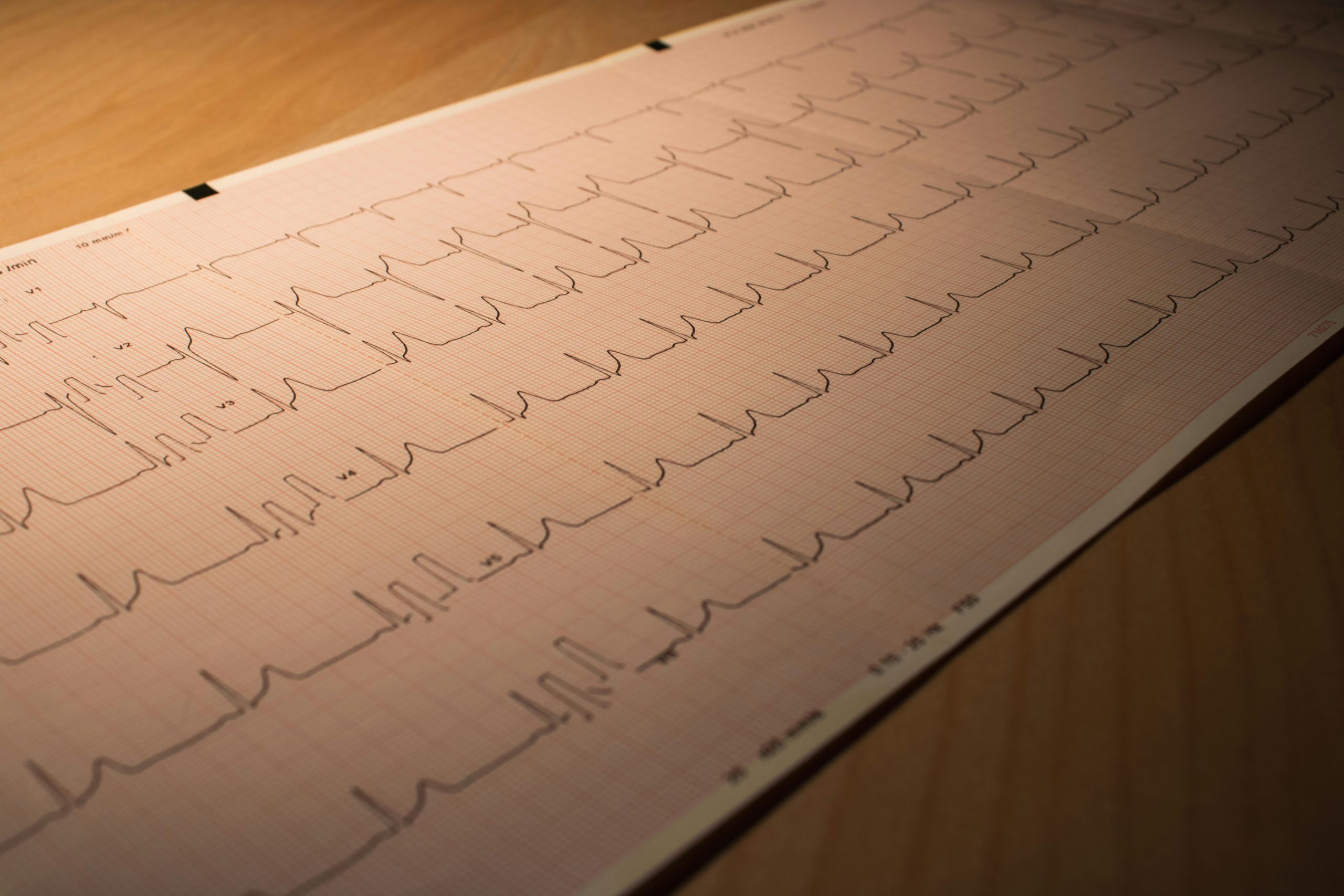 Rêve crise cardiaque interprétation
